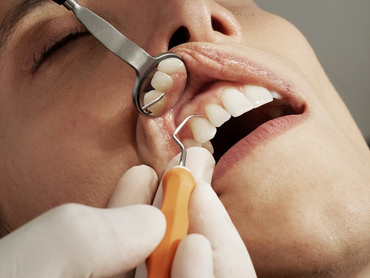 Why Regular Dental Checkups Save Your Teeth — And Your Wallet