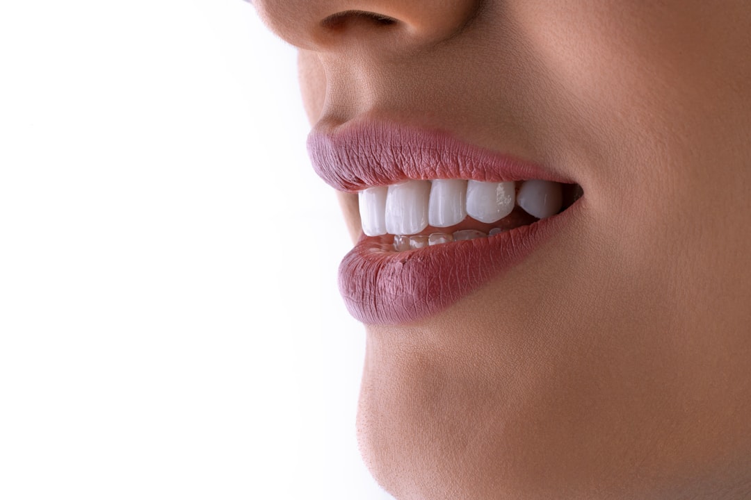 Artificial Teeth in Koparkhairane Navi Mumbai