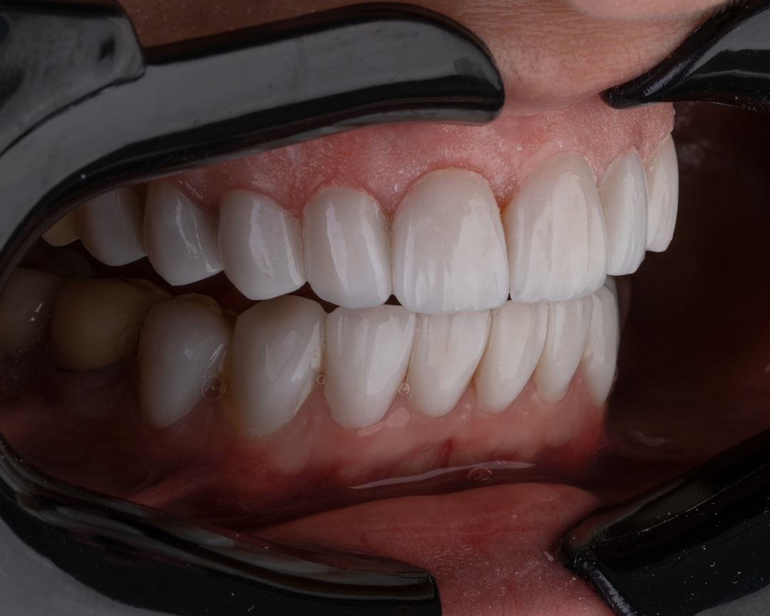 Dentures in Koparkhairane Navi Mumbai