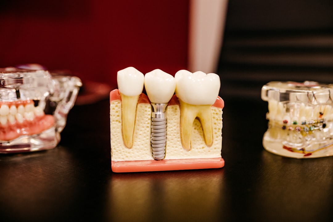 Dental Implants in Koparkhairane Navi Mumbai
