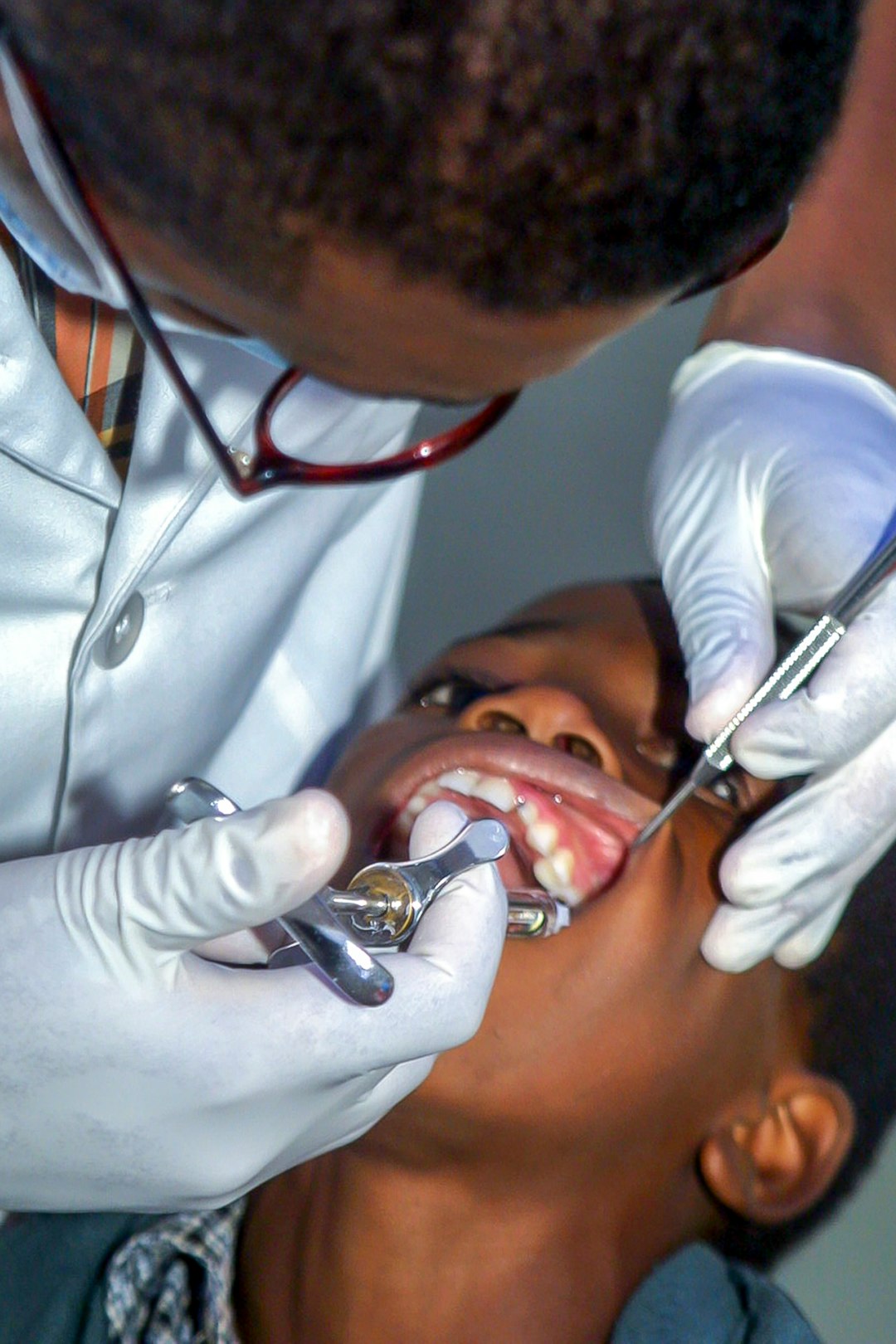 Children Dentistry in Koparkhairane Navi Mumbai