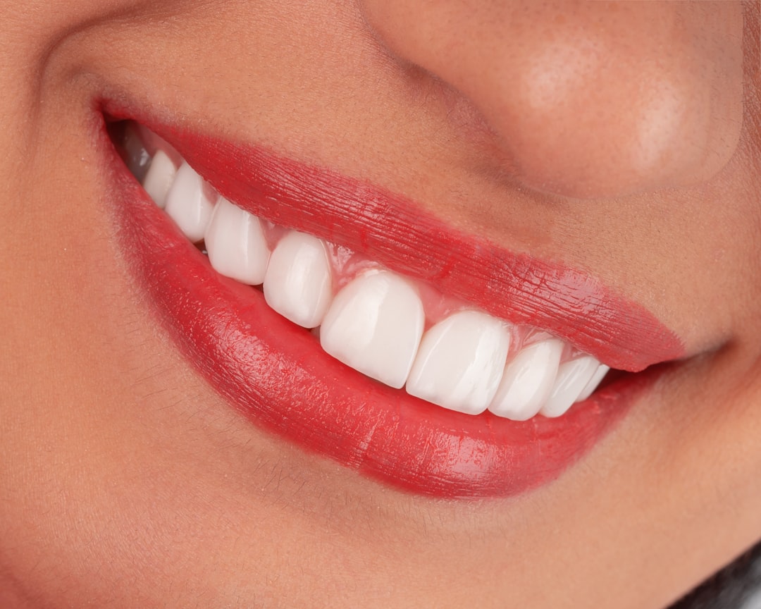Smile Makeover in Koparkhairane Navi Mumbai